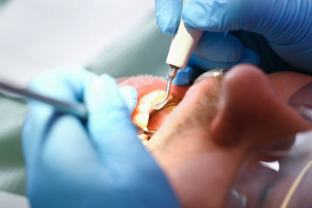 Best Emergency Tooth Extraction  in Hooverson Heights, WV