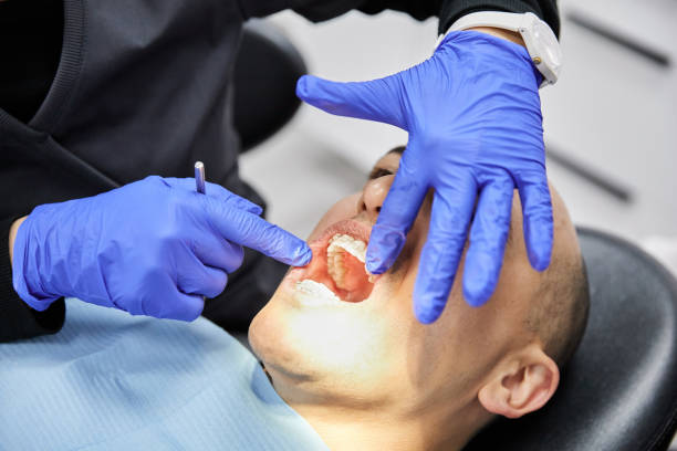Best Dentist for Tooth Abscess  in Hooverson Heights, WV