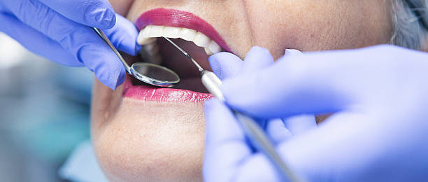 Best Chipped Tooth Repair Near Me  in Hooverson Heights, WV